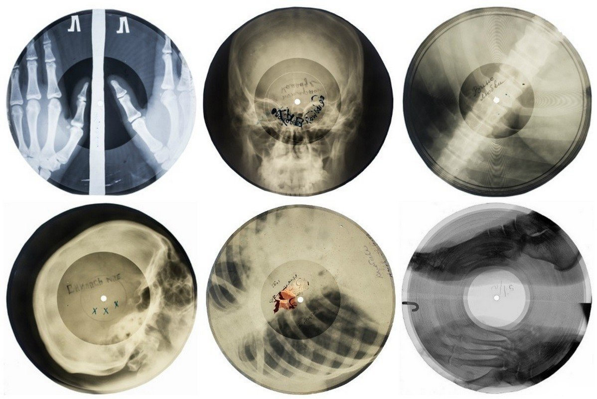 Пластинки из рентгеновских снимков в СССР