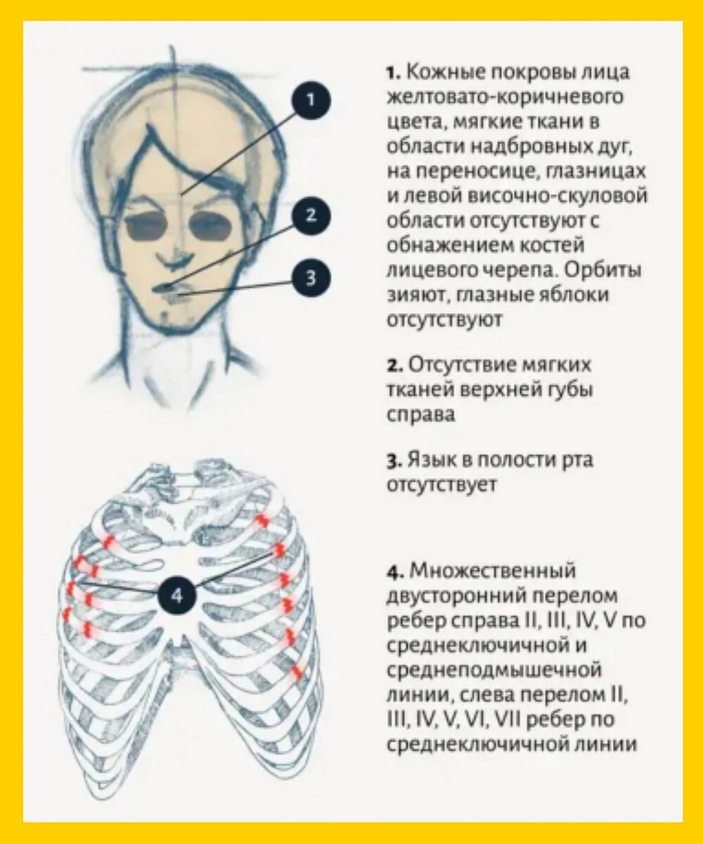 Наглядно, все травмы Дубининой.