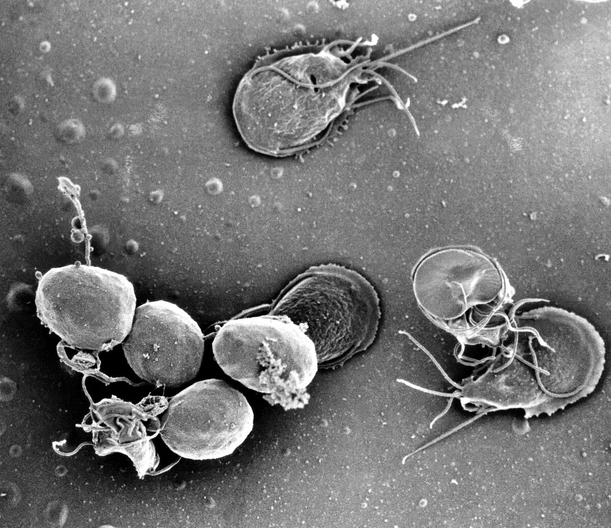 Лямблии - микроскопические организмы, вызывающие кишечные инфекции