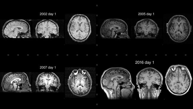 (Image credit: Adluru, N. et al. Neurocase. 2020) 