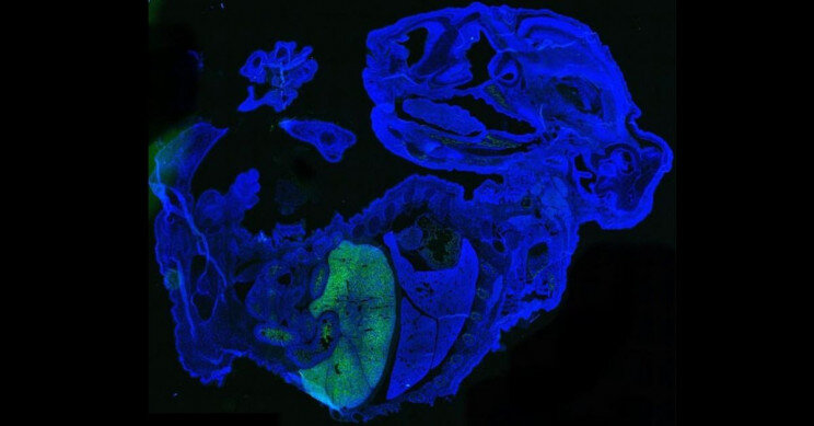 Количество клеток человека (зеленое), показанное в эмбрионе мыши Чжисин Ху / Университет Буффало