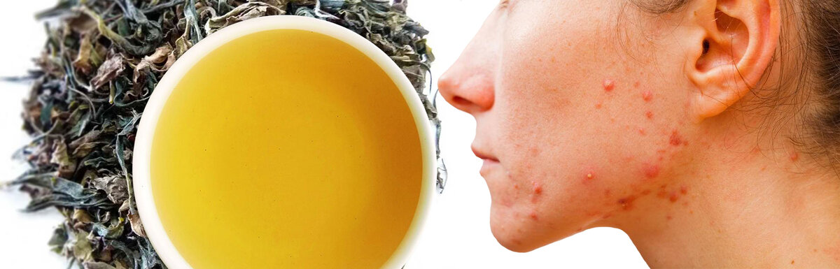 Источник: Яндек картинки