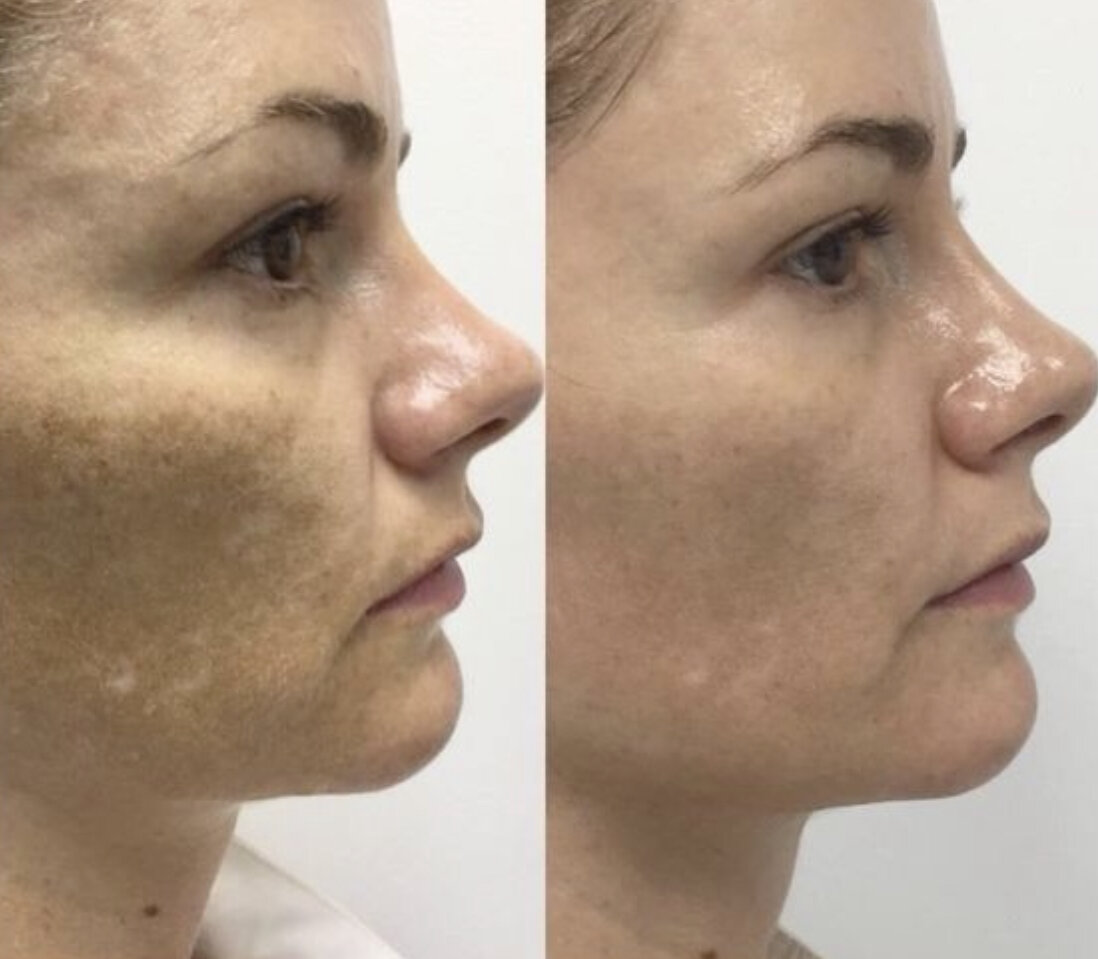 Фотографии моей подруги «БЬЮТИКОМ»
