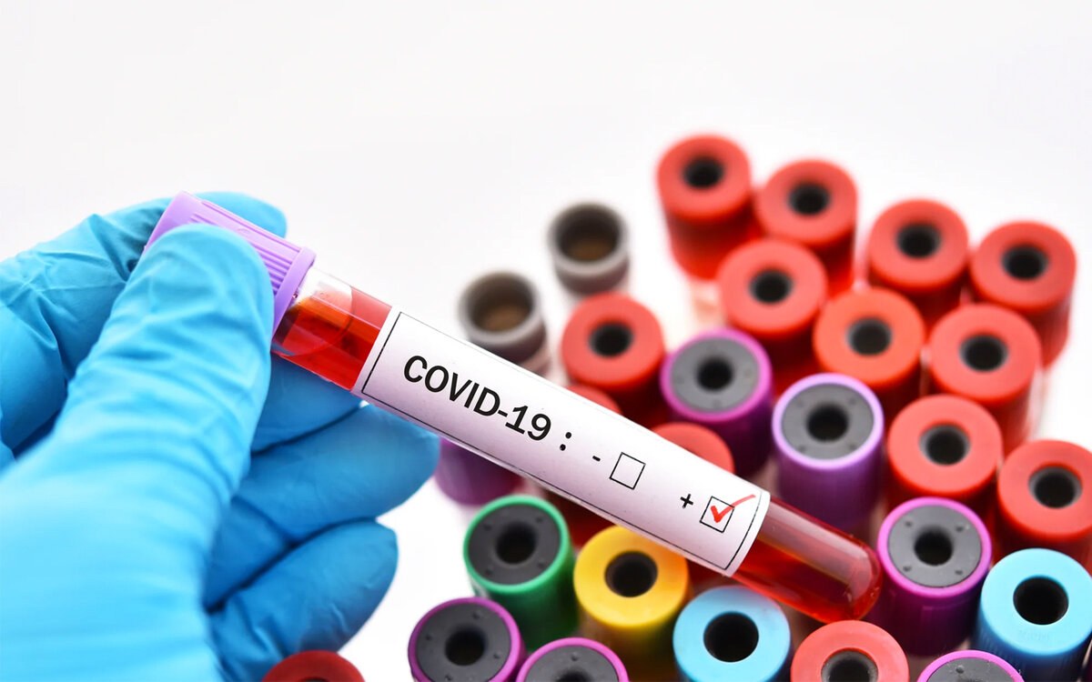 Коронавирусом так или иначе могут заразиться все россияне, поскольку COVID-19 циркулирует в воздухе и разносится бессимптомными больными.