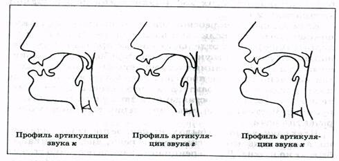 Нарушение голоса, ринолалия. Ринолалия открытая закрытая смешанная. Артикуляционный профиль звуков при ринолалии. Артикуляционные нарушения при ринолалии. Нарушения свистящих при ринолалии.