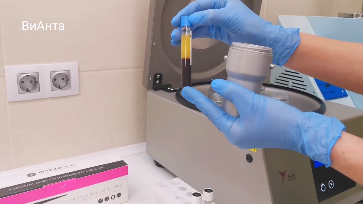 Получили 2 фракции плазмы