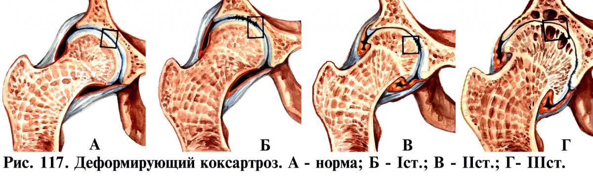 Тренировка для улучшения подвижности тазобедренного сустава.