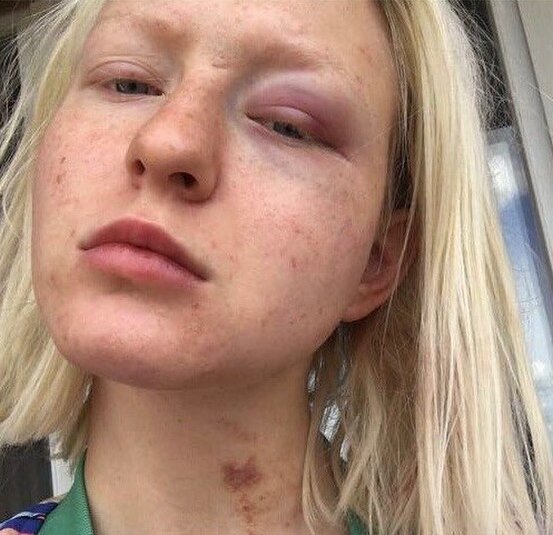 Тося Чайкина
Фото: Instagram
