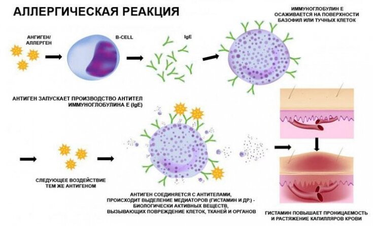 Аллергия на коже: лечение красных пятен и других проявлений