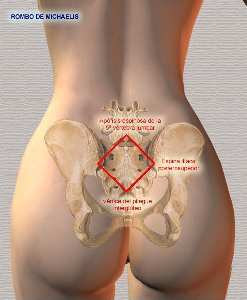 Ромб Михаэлиса