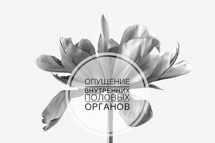 Опущение матки происходит из-за ослабления мышц тазового дна и связок матки. Само по себе опущение матки невозможно и как правило, ему сопутствует опущение влагалища или его выпадение.

Опущение матки может возникать:
▫️после родов (рождение крупного ребенка,
затяжные, тяжёлые и многочисленные роды);
▫️повреждение мышц тазового дна вследствие родовых травм;
▫️дефицит эстрогенов — вследствие менопаузы или после хирургической менопаузы;
▫️ожирение;
▫️хронические респираторные заболевания. ⚠️Очень важно обратить внимание на симптомы, которые проявляются на  ранних стадиях опущения матки:
▫️тянущие боли, давление внизу живота, крестце, поясницы;
▫️ощущение инородного тела во влагалище;
▫️болезненный половой акт;
▫️нарушения менструального цикла;
▫️менструальный цикл становится более болезненным.
🆘При отсутствии лечения могут возникать:
▫️затруднение и/или учащение мочеиспускания, которое может приводить к воспалительным процессам в мочеполовых органах;
▫️недержание мочи;
▫️недержание газов, кала, запоры, колиты;
▫️варикозное расширение вен малого таза.

ПРОФИЛАКТИКА
Физические упражнения направленные на тренировку мышц тазового дна.
✏️«Болезнь легче предупредить, чем лечить»
