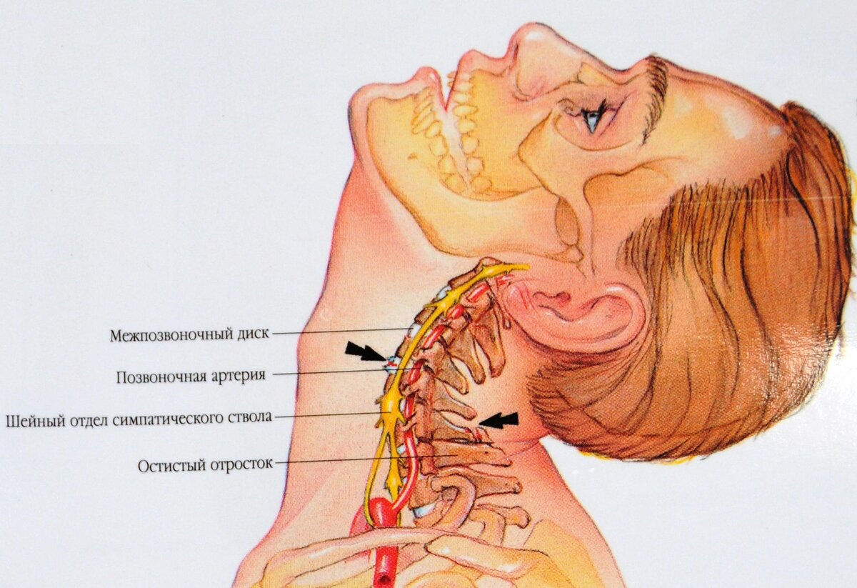 Хрустит позвоночник. Основные причины. НДЦ Королев