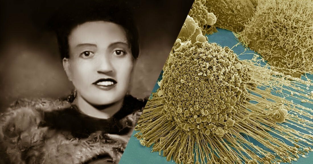 Бессмертные клетки рака у пациентки Генриетты Лакс живы до сих пор спустя 80 лет после смерти самой женщины.