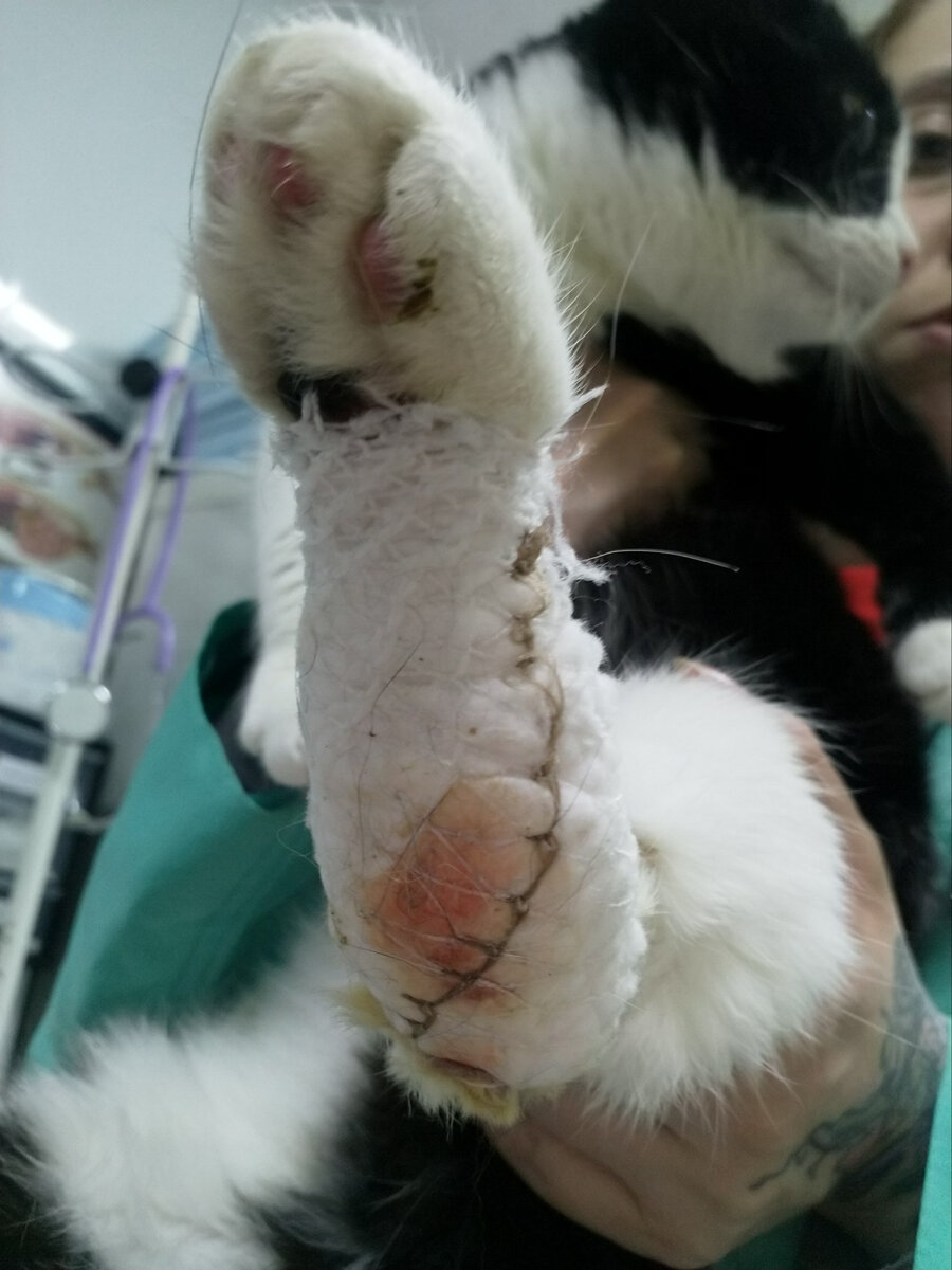 На фото рана забинтована, проложена бранолиндом