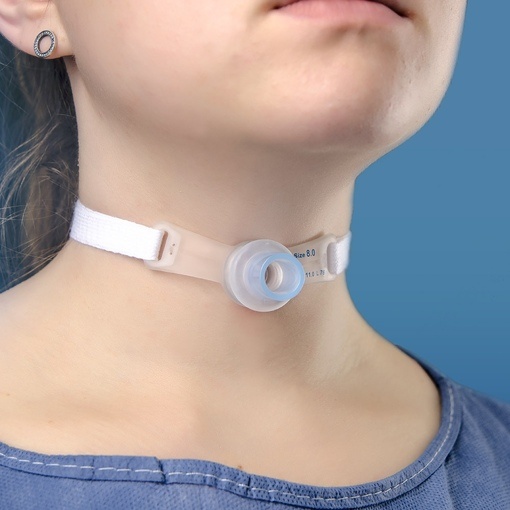 Фото из интернета: https://alfamedex.ru/uploads/catalogue/respiratory_and_anestesia/TT/rtrach/06.jpg