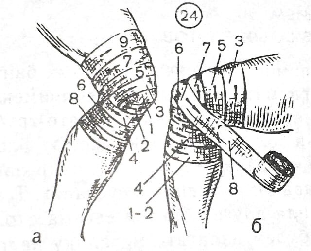 а) расходящаяся б) сходящаяся Источник: А.П. Юрихин "Десмургия"
