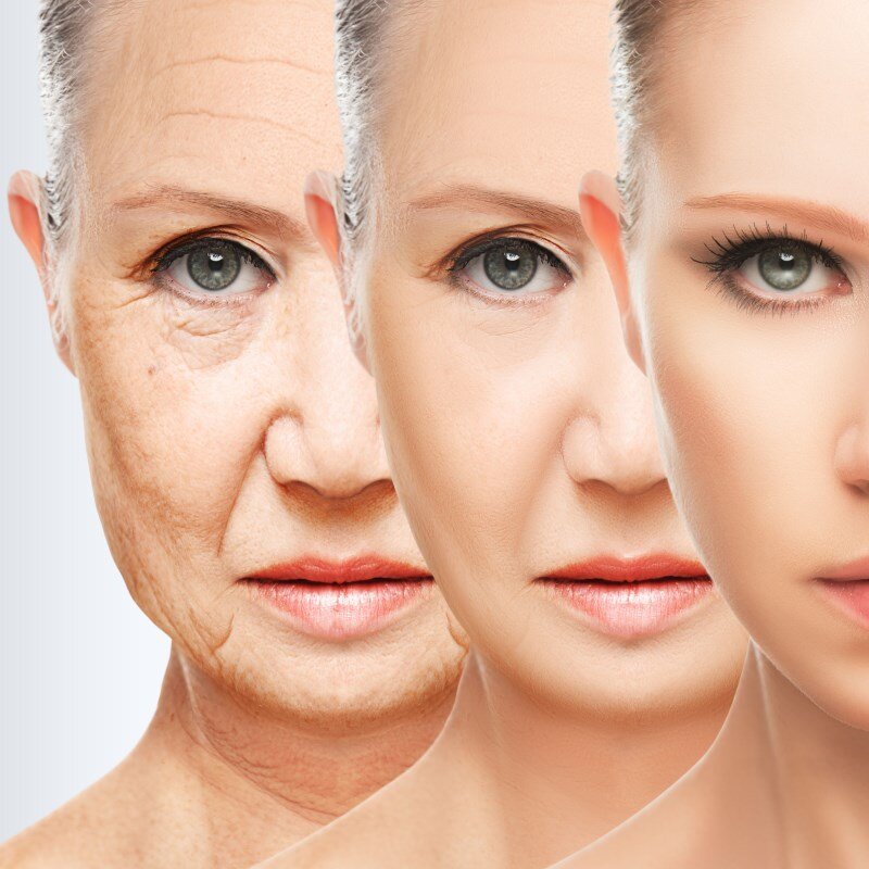 Эффект омоложения от лазерного пилинга