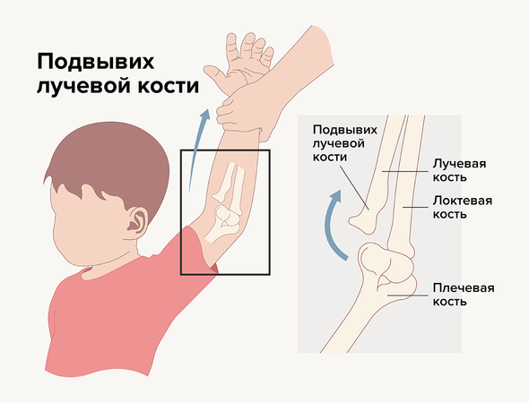    Иллюстрация: Pepermpron / Shutterstock / Fotodom