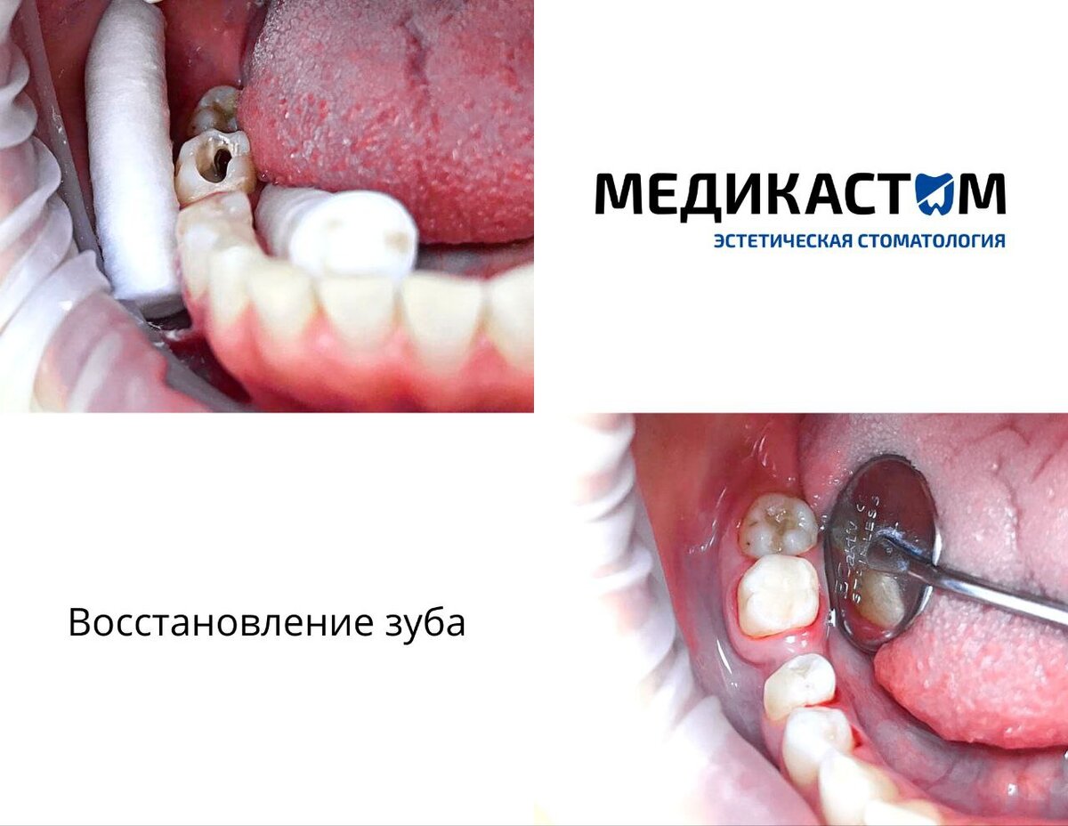 У нас работают опытные врачи. Все они в совершенстве освоили эстетическую стоматологию!