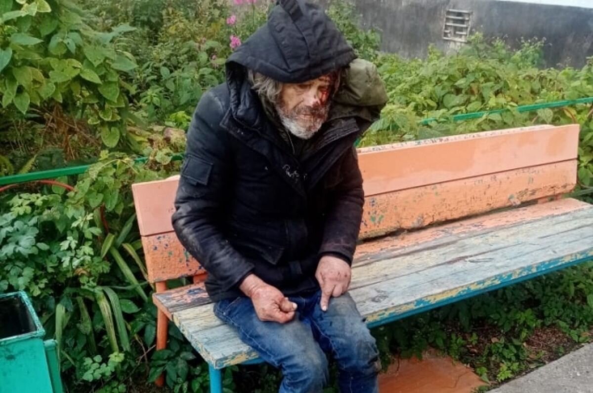    В Тверской области мужчина скитается по улицам и спит на дороге