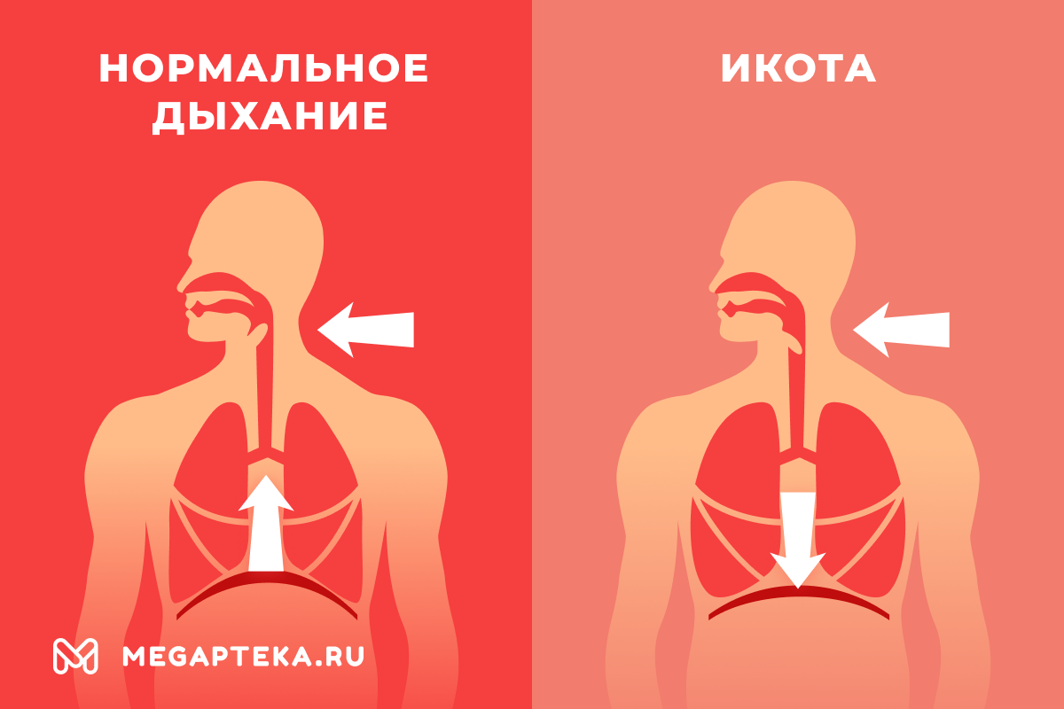 Смертельно опасный холод: что испытывает человек при сильной гипотермии