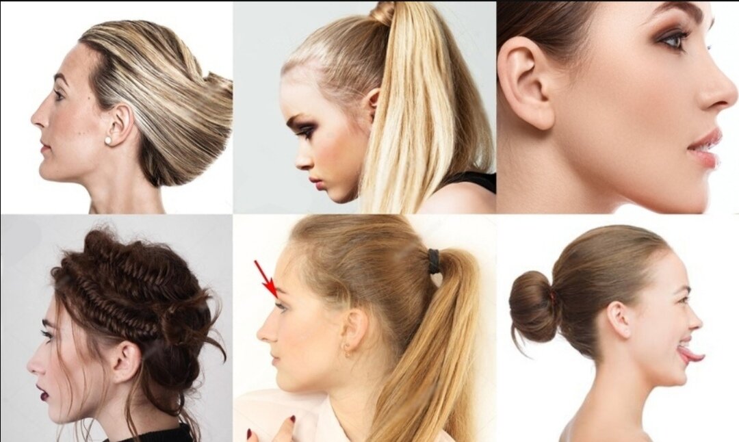 Впалые глаза