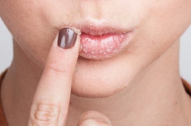 Бальзам для губ своими руками: 3 простых рецепта