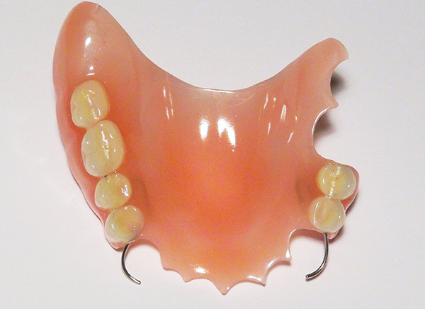 Пластиночный съемный протез. Представляет собой ряд искусственных зубов, закрепленных на пластмассовой пластине. Крепится к сохранившимся зубам пациента с помощью металлических крючков