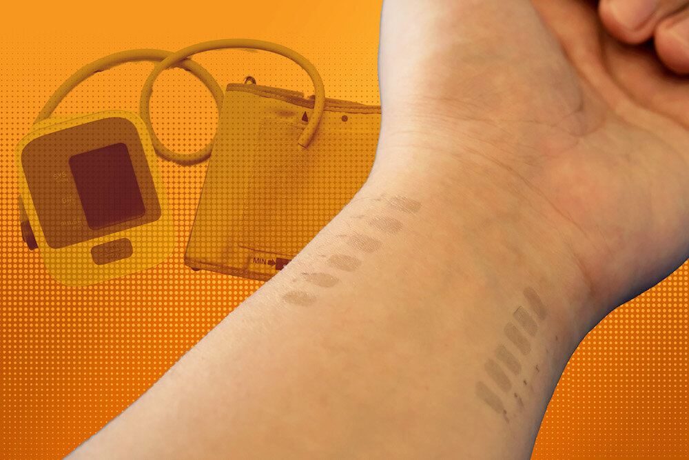 Исследователи разработали электронную татуировку, которую можно удобно носить на запястье для мониторинга кровяного давления в течение нескольких часов.