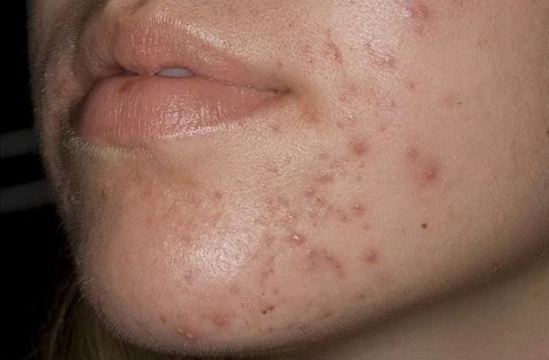 Яндекс Картинки 