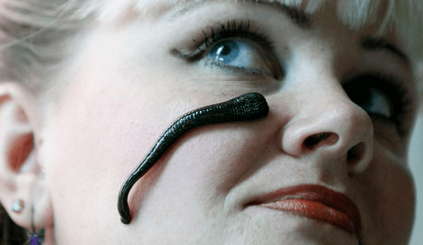 Не очень приятная, сцена. Сеанс Герудо-терапии