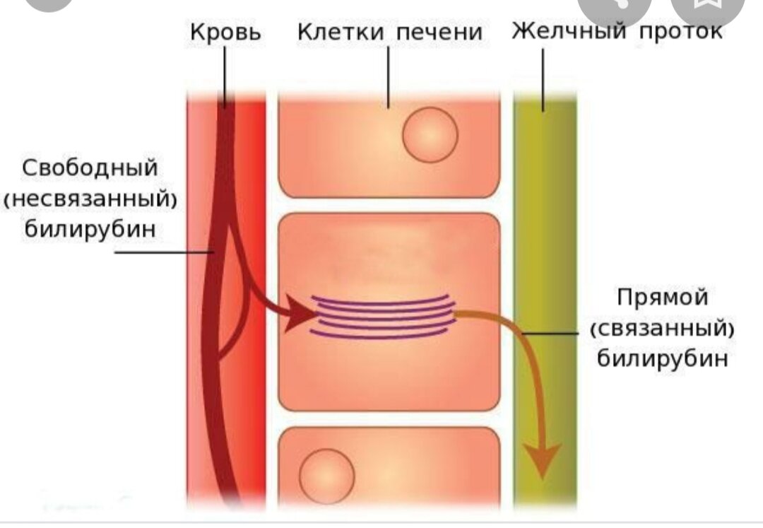 Синдром Жильбера