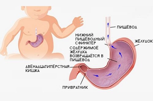 Срыгивания у детей первого года жизни - Семейная Клиника Александровская