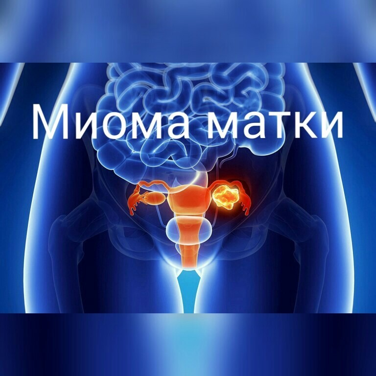 картинка с поиска 