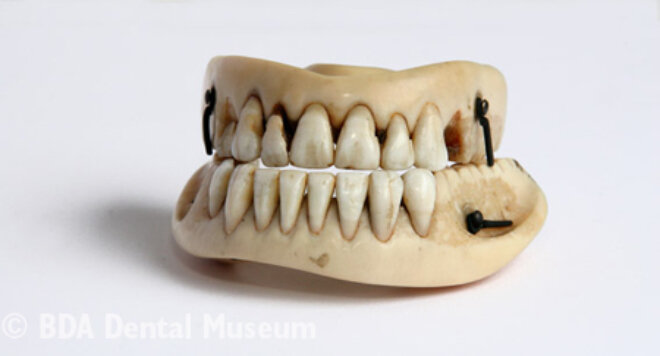 Вот так выглядел зубной протез с зубами погибших солдат. Фото из музея Британской стоматологической ассоциации