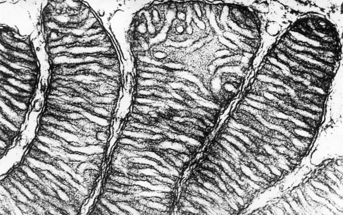 Здесь отчетливо видны кристы - складки внутренней мембраны митохондрий.