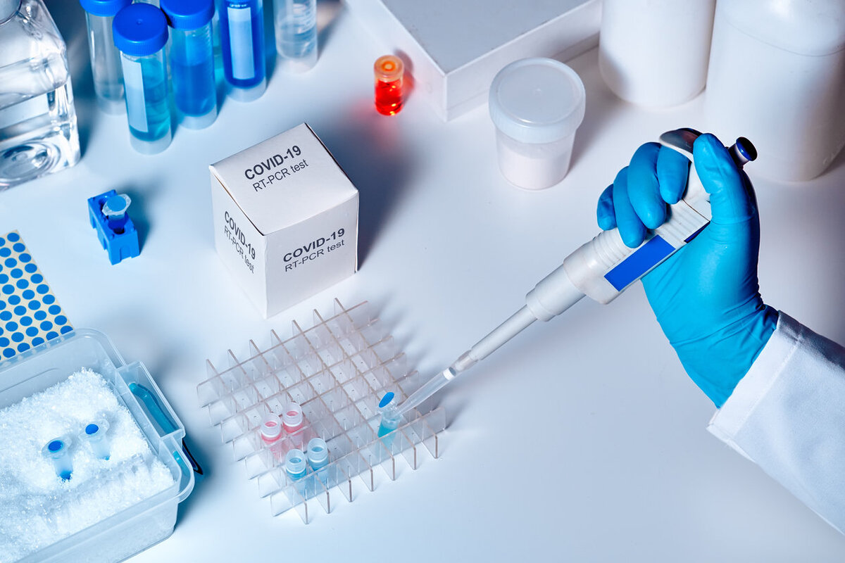 Источник фото:https://rg.ru/2020/04/14/reg-sibfo/v-novosibirske-nachali-vypusk-bystrogo-testa-na-koronavirus.html