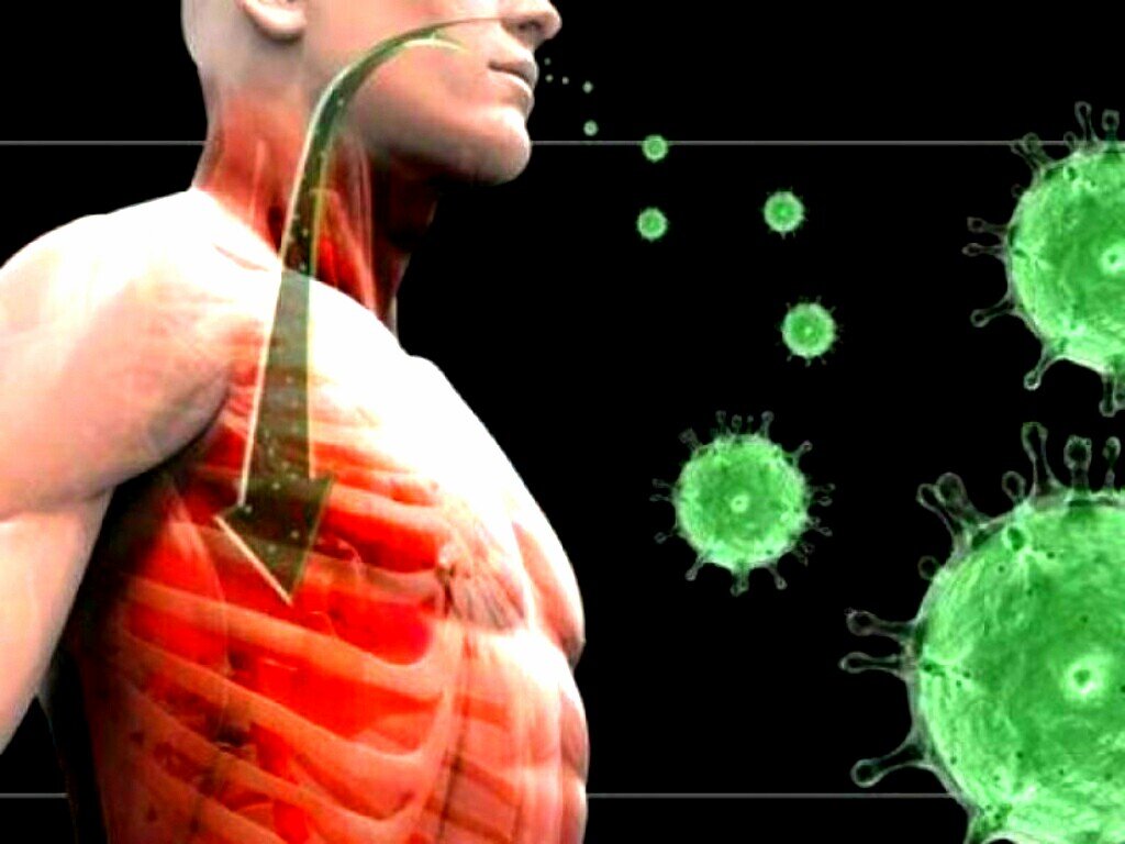 Вирус пневмонии картинки