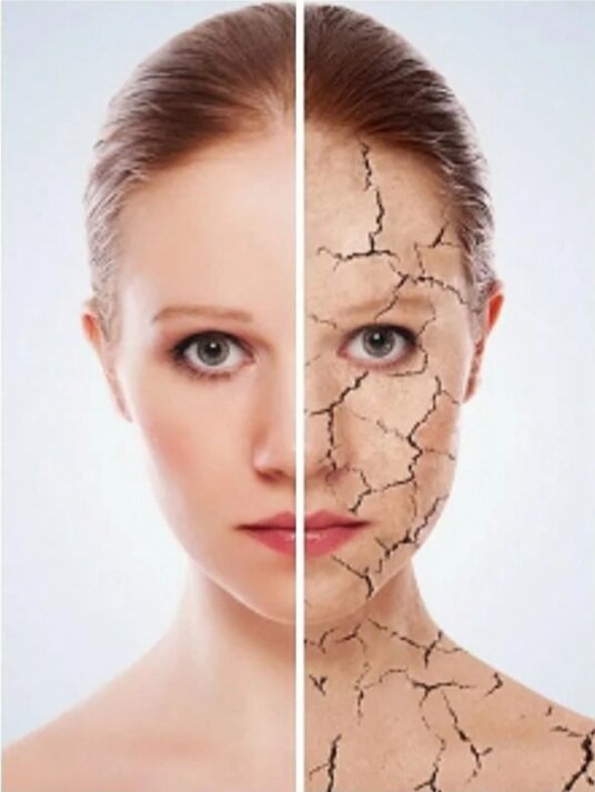 Обезвоживание организма 