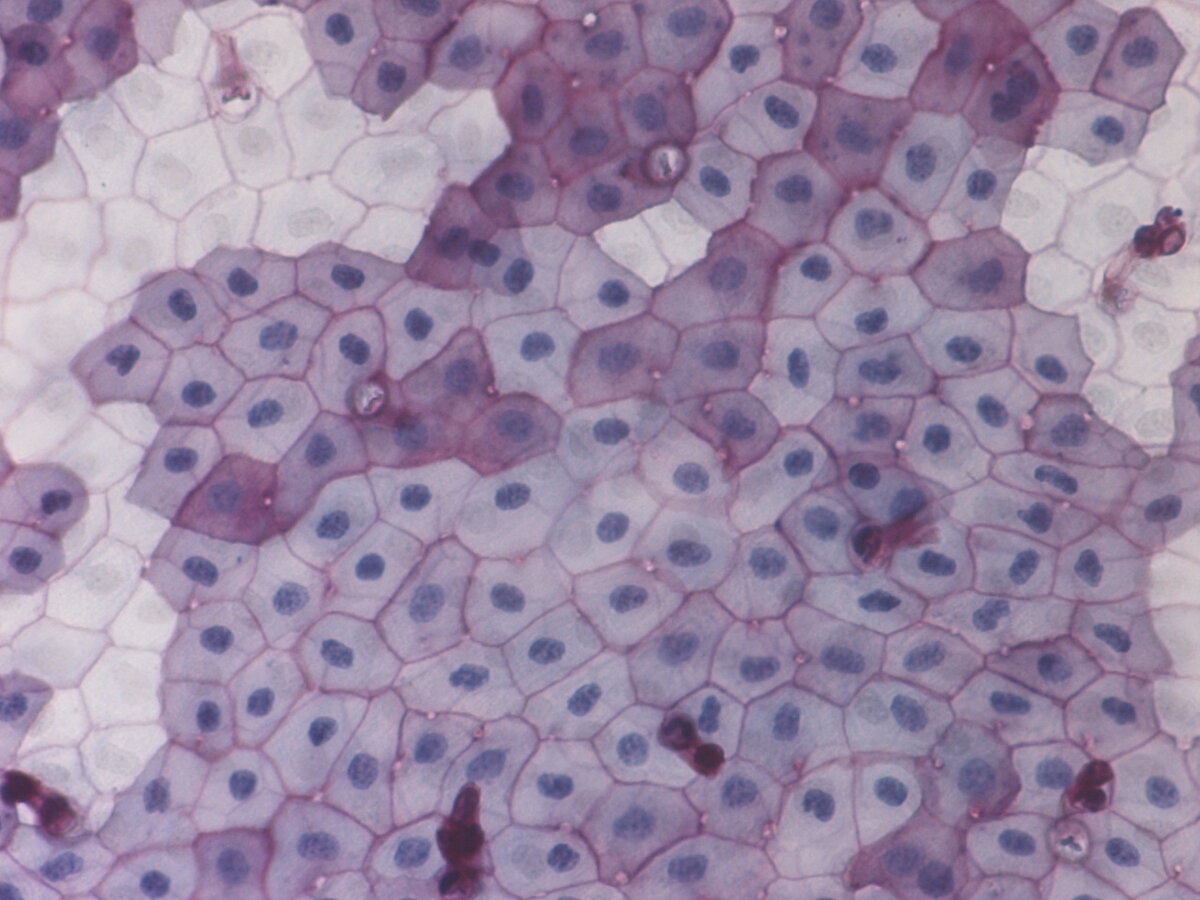 Типы тканей под микроскопом Hyaline cartilage, from StudyBlue. "Here I am, looking out on a crystal world, f