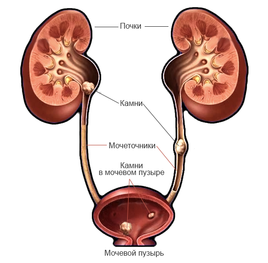 Препараты при болях в почках