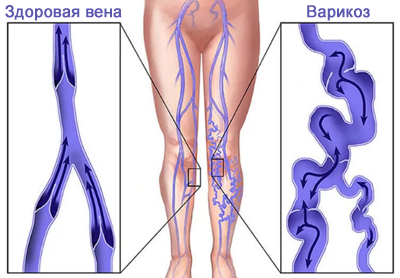 Источник: Яндекс картинки