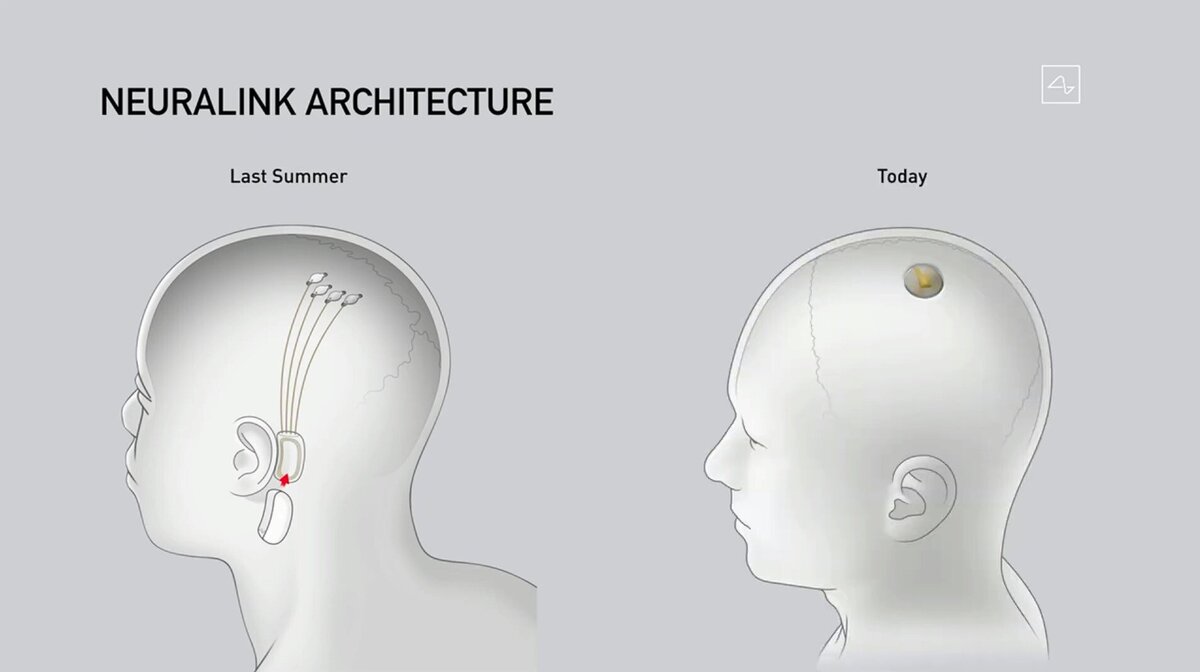 Чип Neuralink полностью изменил дизайн и форму