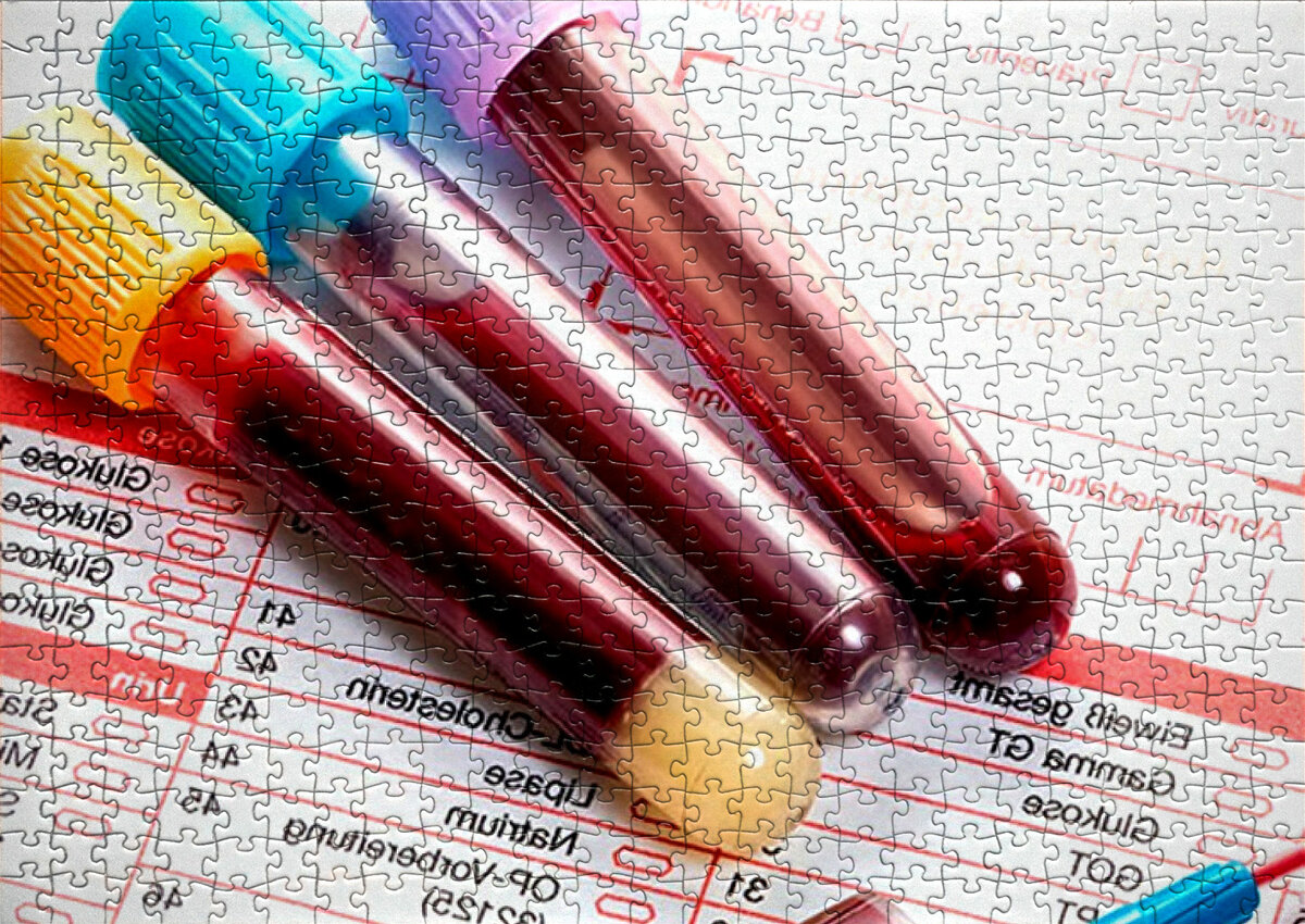 Картинка создана в фоторедакторе.