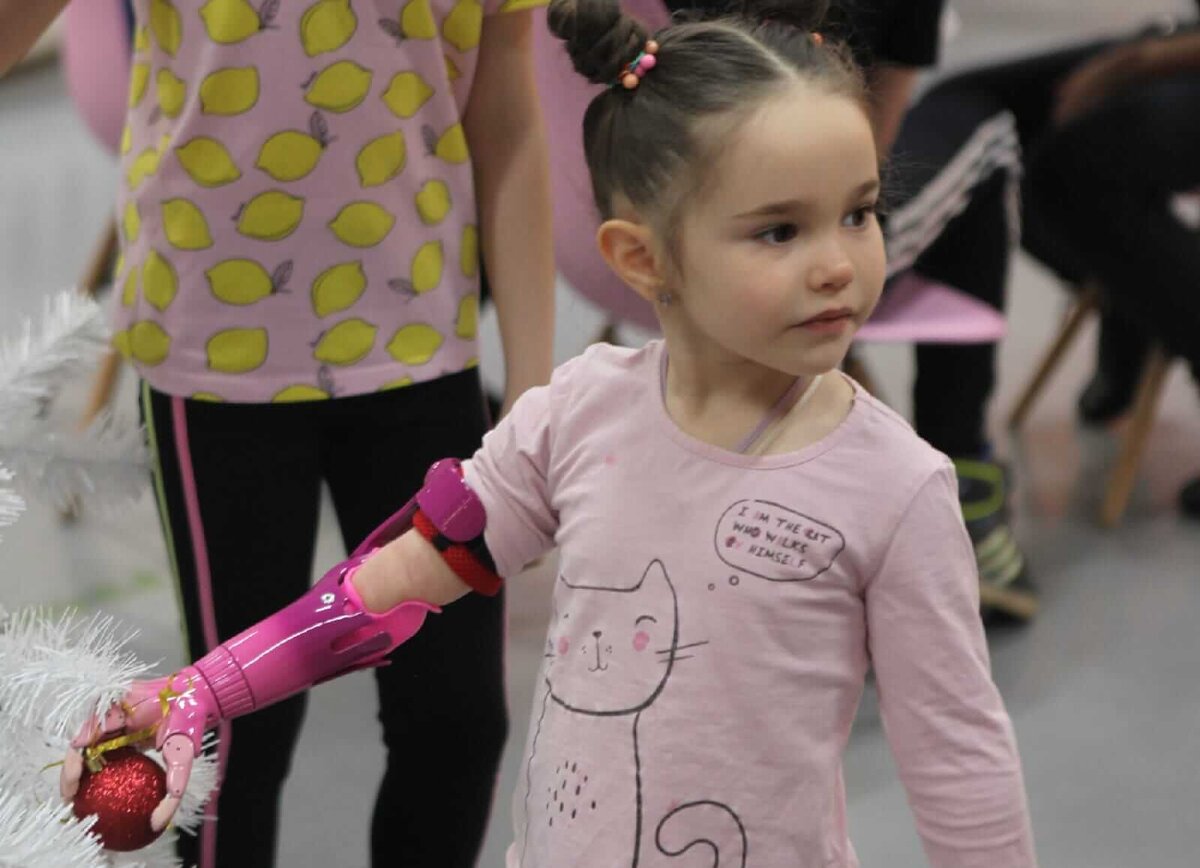 Несмотря на то, что это первый протез, девочка освоила его с поразительной легкостью 