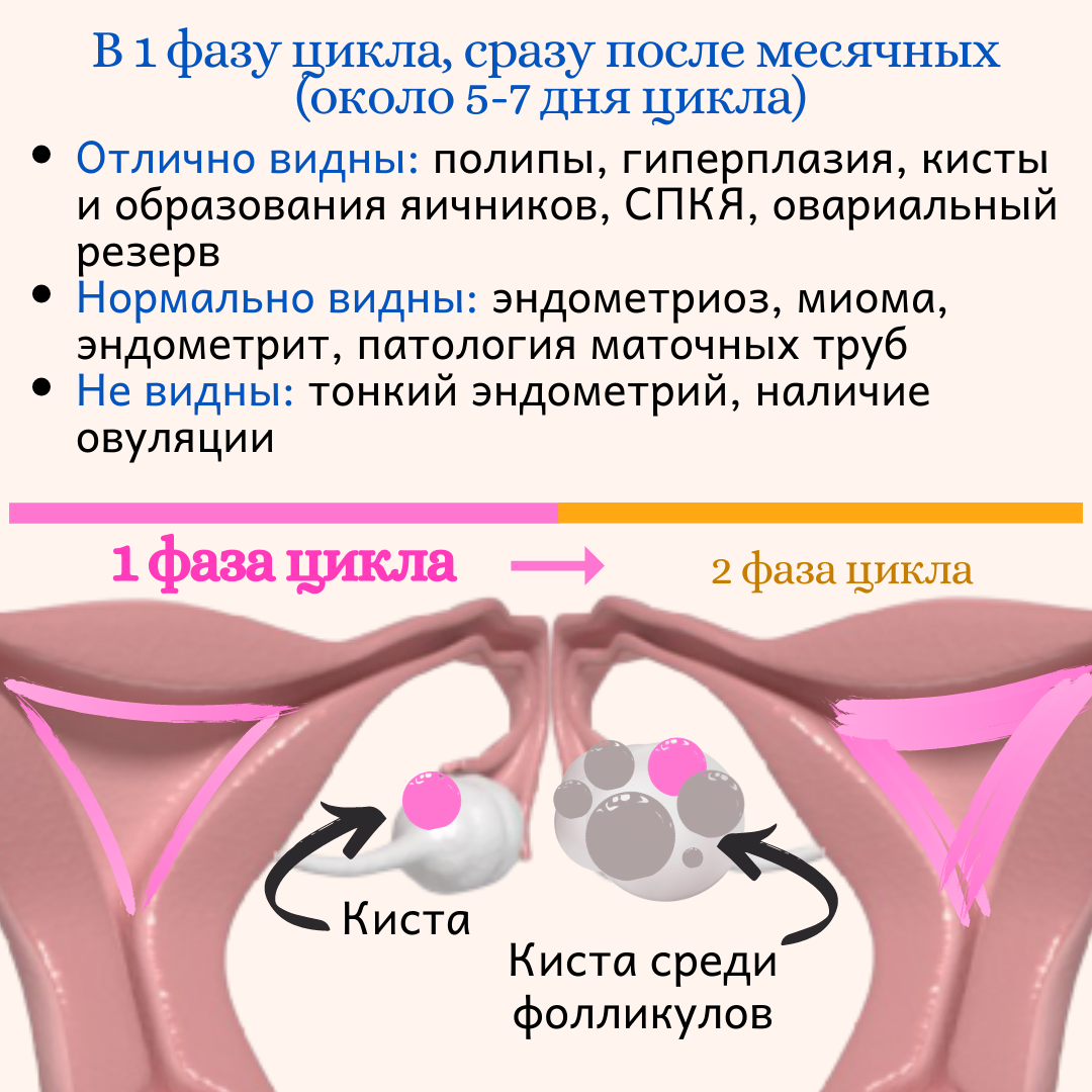 На какой день цикла делать узи молочных