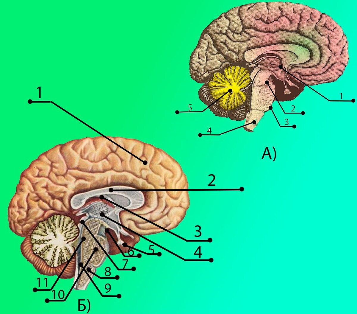                                                             Рис.1 Структуры мозга.                                                            А) Основные структуры головного мозга: 1 - Промежуточный мозг, 2 - Средний мозг, 3 - Мост, 4 - Продолговатый мозг (ниже уже располагается ствол мозга), 5 - Мозжечок.
Б) Модель ТРИЕДИНОГО МОЗГА: 1 - Неокортекс (большие полушария переднего мозга), 2 - мозолистое тело, 3 - Свод -  4 - Таламус, 5 - Гипофиз, 6 - Сосцевидное тело, 7 - Сильвиев водопровод,  8 - Продолговатый мозг, 9 - Четвертый желудочек, 10 - Варолиев мост, 11 - Рептильная часть мозга. Лимбическая структура  включает в себя все части и частично полушарии головного мозга (для простоты условно рассматриваем область вокруг структур под цифрами: 2-11)
