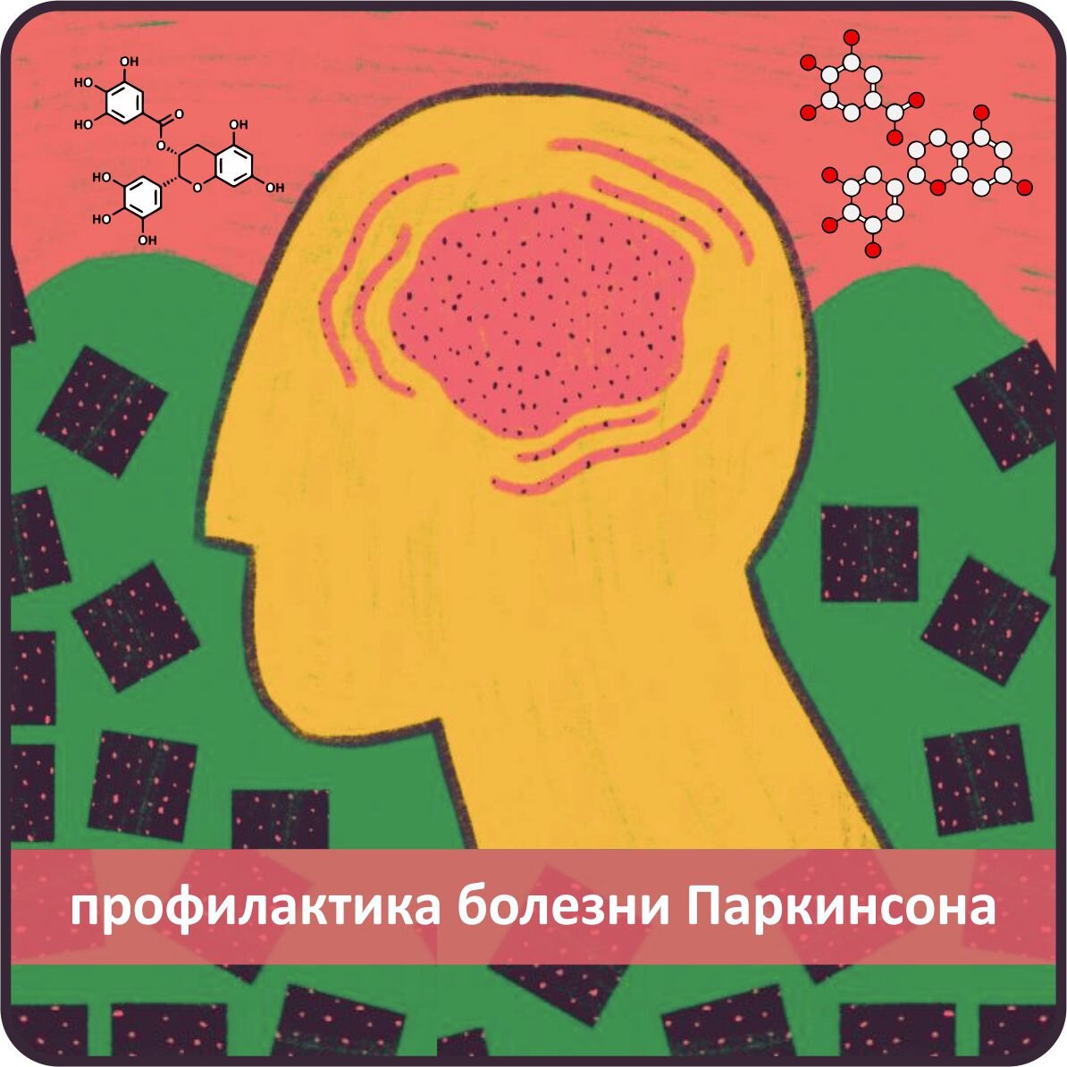 Оливковое масло экстра класса поможет избежать  поражения болезнью Паркисона. Высоко содержание полифенолов в  оливковом масле экстра класса  на сайте Оливадар. 