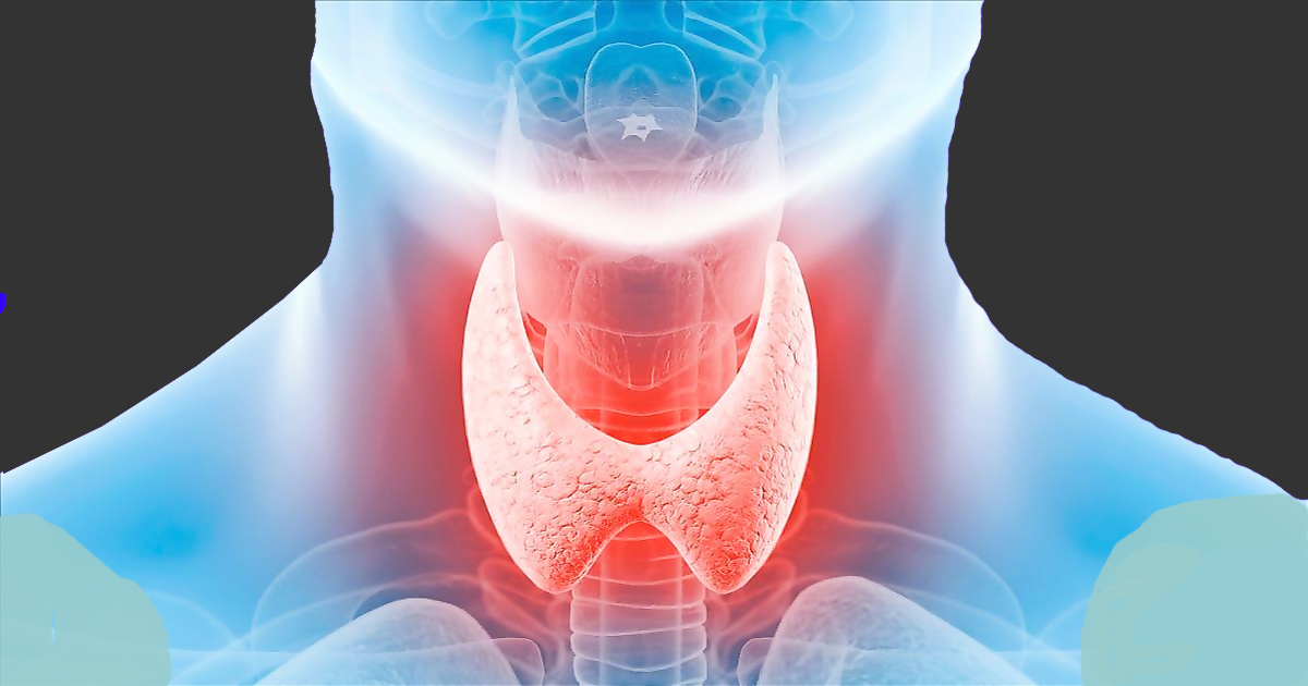 Рак щитовидной железы