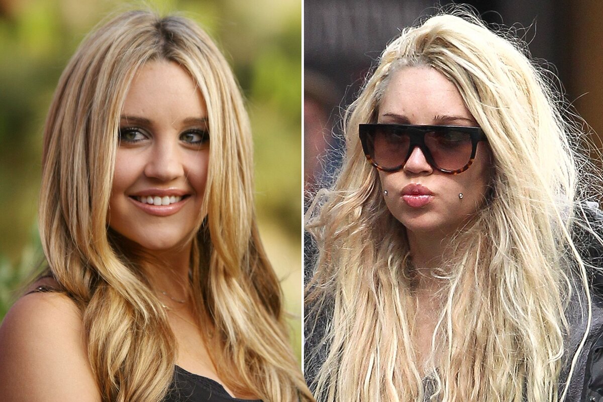 Слева - Аманда на пике славы, справа - после очередного выхода из рехаба